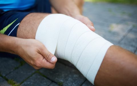 Differences Between Varicose Veins and Spider Veins