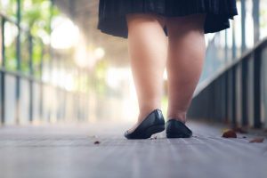 ankles swollen - cankles