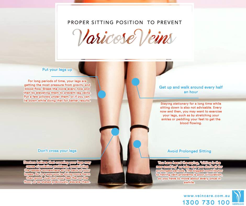 Proper Sitting Positions To Prevent Varicose Veins