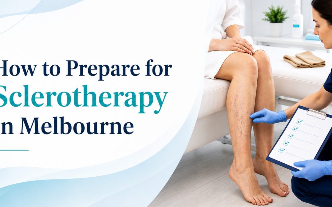 How to Prepare for Sclerotherapy in Melbourne