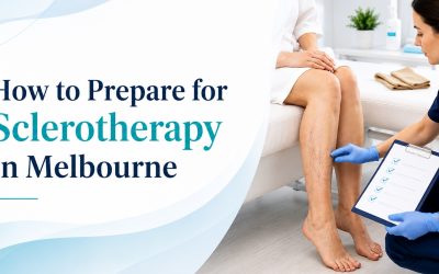 How to Prepare for Sclerotherapy in Melbourne