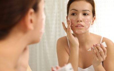 DIY Skin Care Treatment for Rosacea