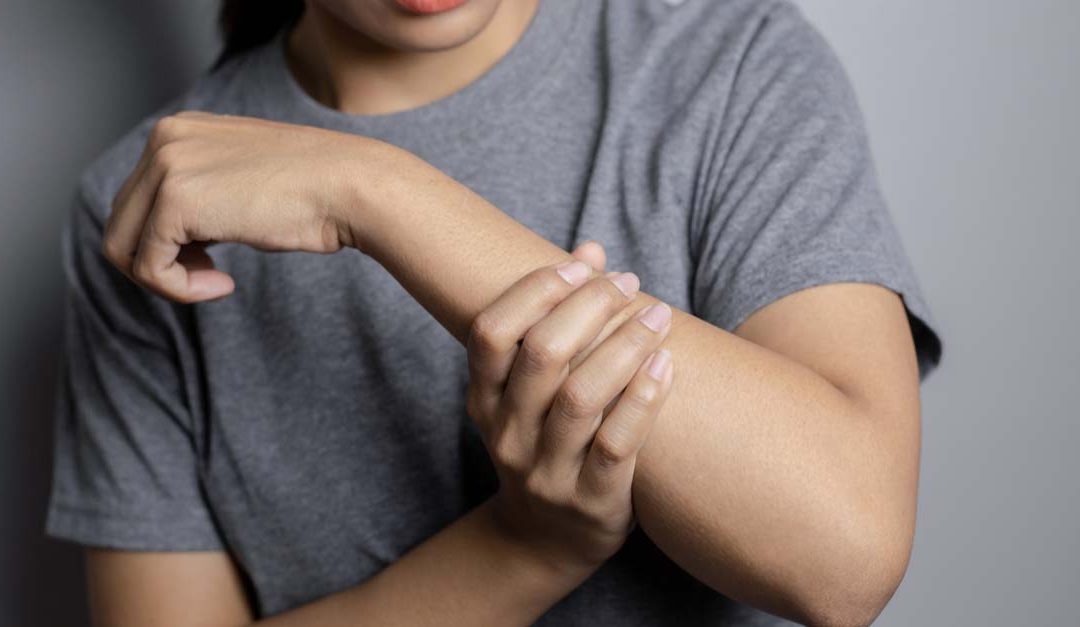 What Do Squiggly Veins in Arms Mean?