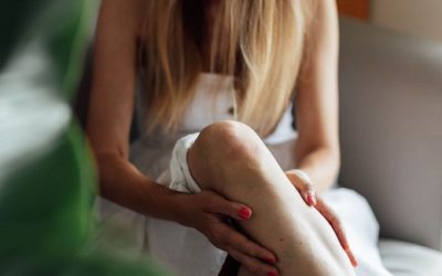 The Psychological Impact of Varicose Veins, Melbourne