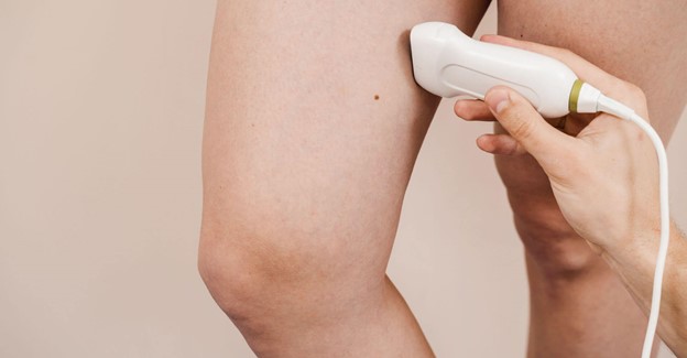 4 Tips for Maintaining Vein Health at Work in Melbourne