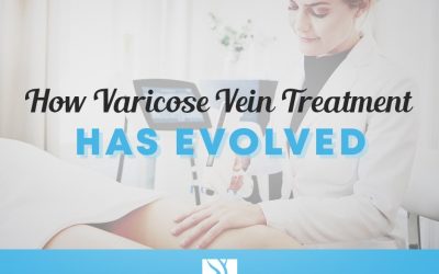 The History of Varicose Vein Treatments