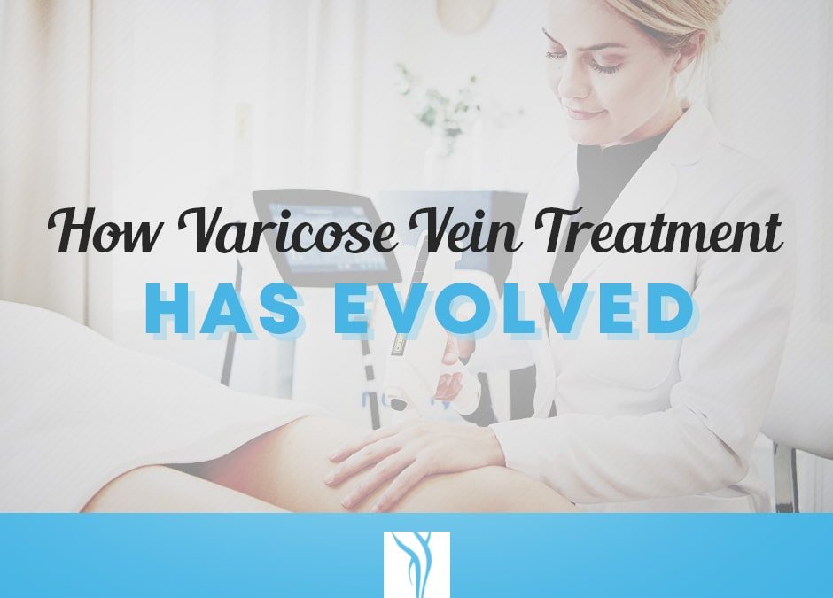 The History of Varicose Vein Treatments